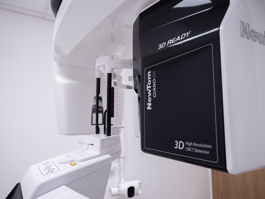 Panoramatický röntgen (OPG)